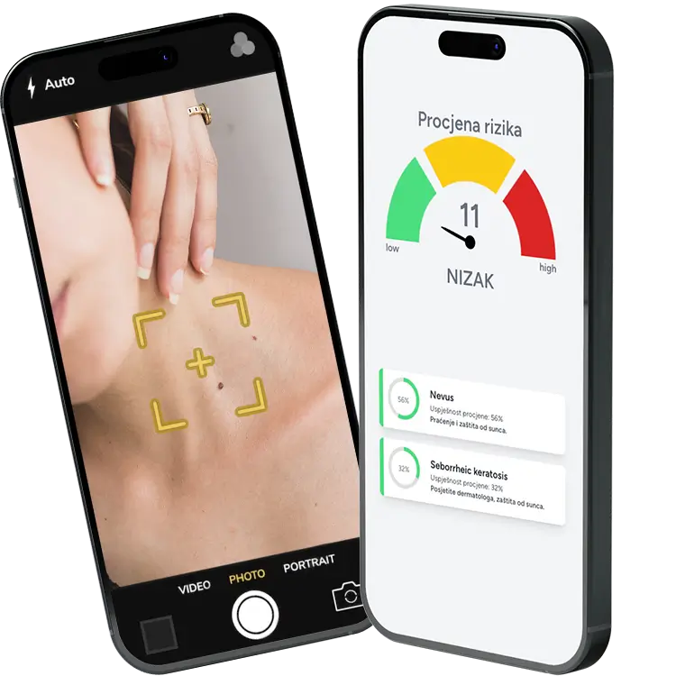AI skin check